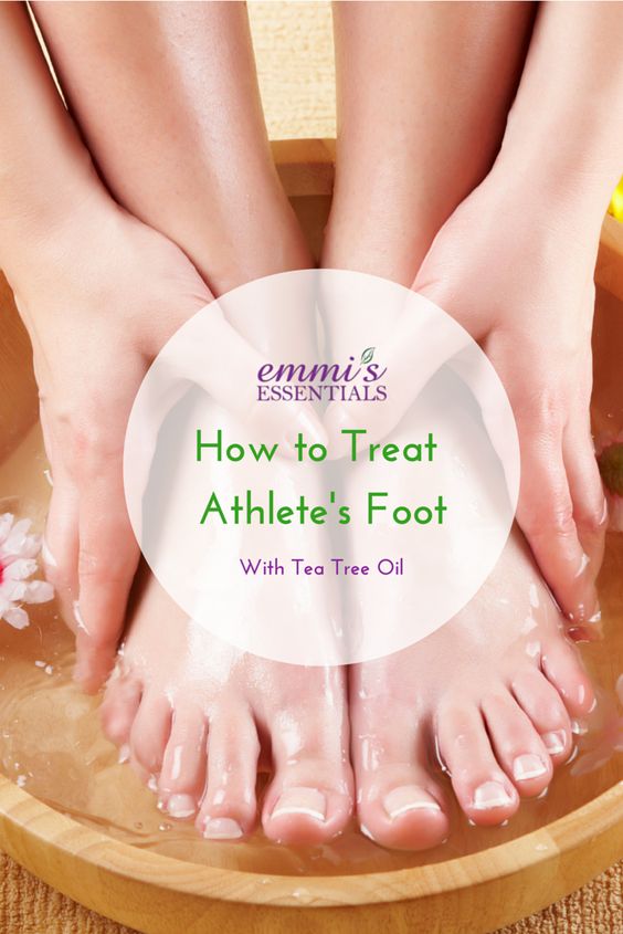 How to Treat Athlete’s Foot with Tea Tree Oil Video